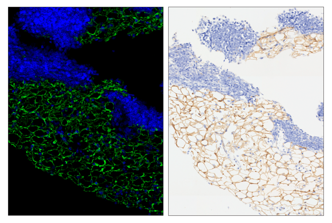 Immunohistochemistry Image 6: CD36 (E8B7S) & CO-0089-750 SignalStar<sup>™</sup> Oligo-Antibody Pair