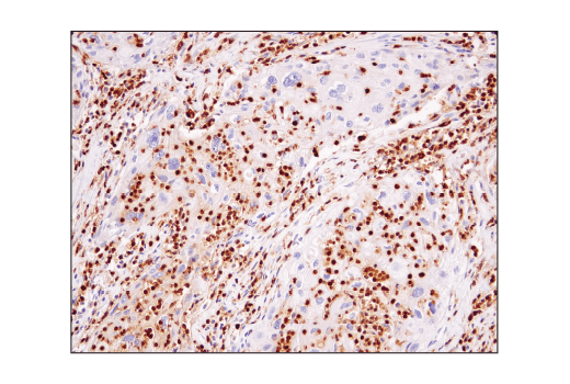 undefined Image 68: Suppressive Myeloid Cell Phenotyping IHC Antibody Sampler Kit