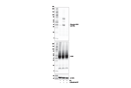 Western Blotting Image 2: Phospho-CD28 (Tyr191) (E5B9Z) Rabbit Monoclonal Antibody
