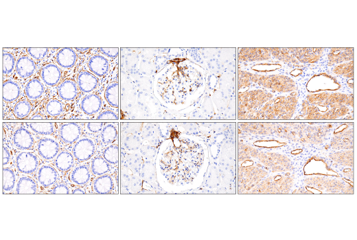 Immunohistochemistry Image 10: MCAM (E3F3E) Rabbit Monoclonal Antibody (BSA and Azide Free)