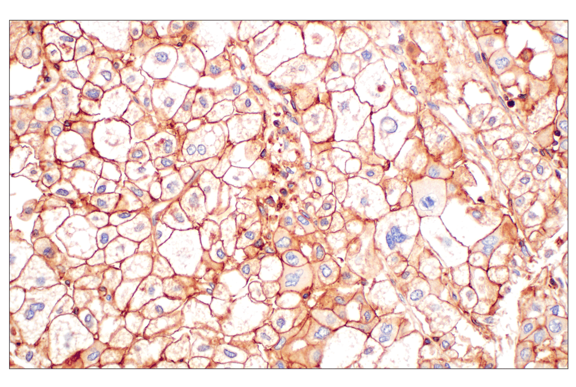 Immunohistochemistry Image 4: CD58 (F1C9B) Rabbit Monoclonal Antibody