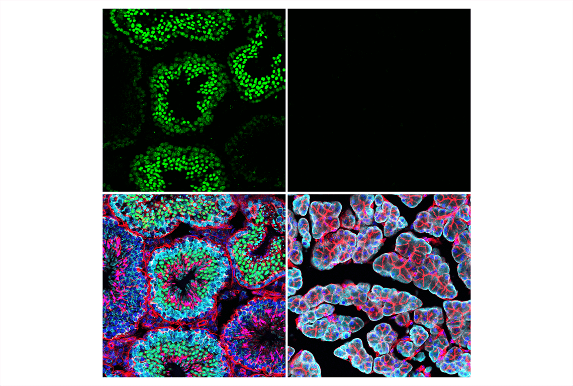 Immunofluorescence Image 1: ATAD2 (E8Y7F) Rabbit Monoclonal Antibody