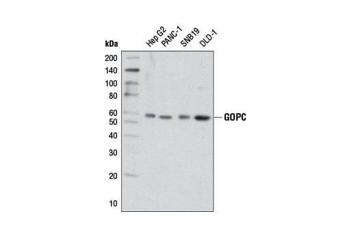 undefined Image 16: Vesicle Trafficking Antibody Sampler Kit