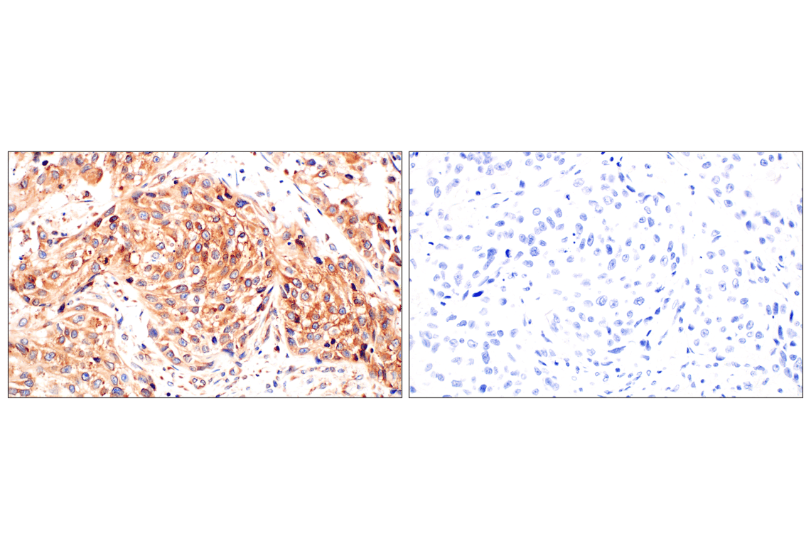 Immunohistochemistry Image 11: RACK1 (D59D5) Rabbit Monoclonal Antibody (BSA and Azide Free)