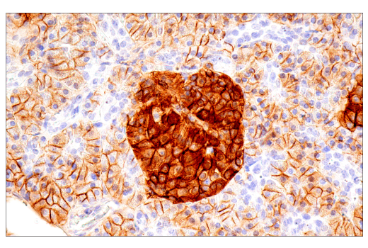 Immunohistochemistry Image 9: CD99 (PCB1) Mouse Monoclonal Antibody