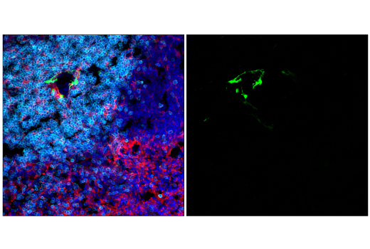 Immunofluorescence Image 1: S100B (E7C3A) Rabbit Monoclonal Antibody