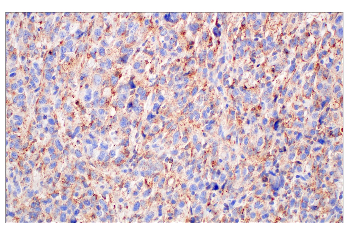 Immunohistochemistry Image 8: NPC1 (E7S4N) Rabbit Monoclonal Antibody