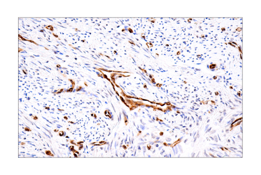 Immunohistochemistry Image 9: Tapasin (E6P2Z) Rabbit Monoclonal Antibody (BSA and Azide Free)