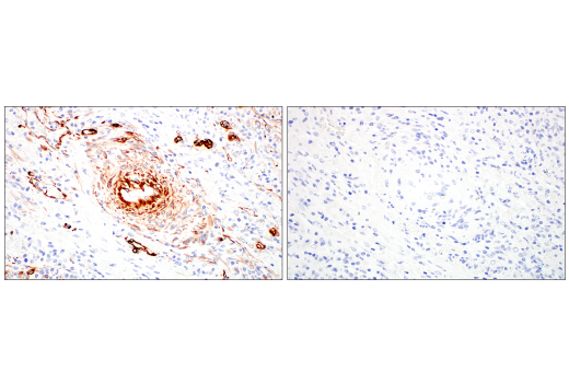 Immunohistochemistry Image 13: Nestin (E4O9E) Rabbit Monoclonal Antibody (BSA and Azide Free)