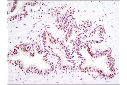 Immunohistochemistry Image 3: SP1 (D4C3) Rabbit Monoclonal Antibody (BSA and Azide Free)