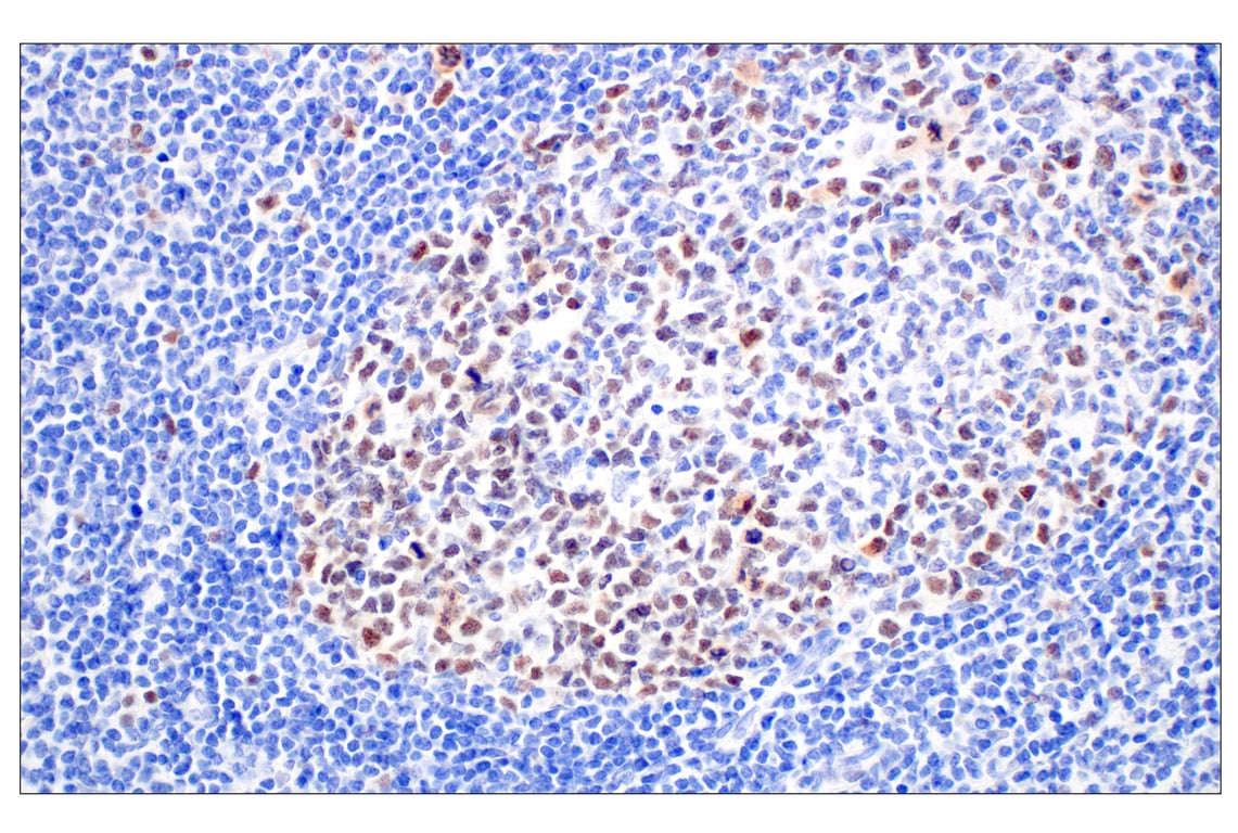 Immunohistochemistry Image 9: BRCA1 (E5S9G) Rabbit mAb (BSA and Azide Free)