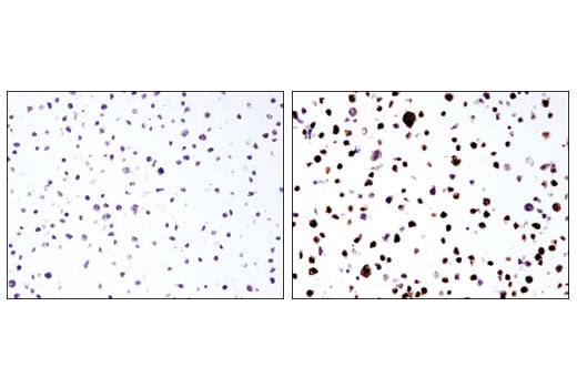 Immunohistochemistry Image 3: IL-1 beta (3A6) Mouse Monoclonal Antibody