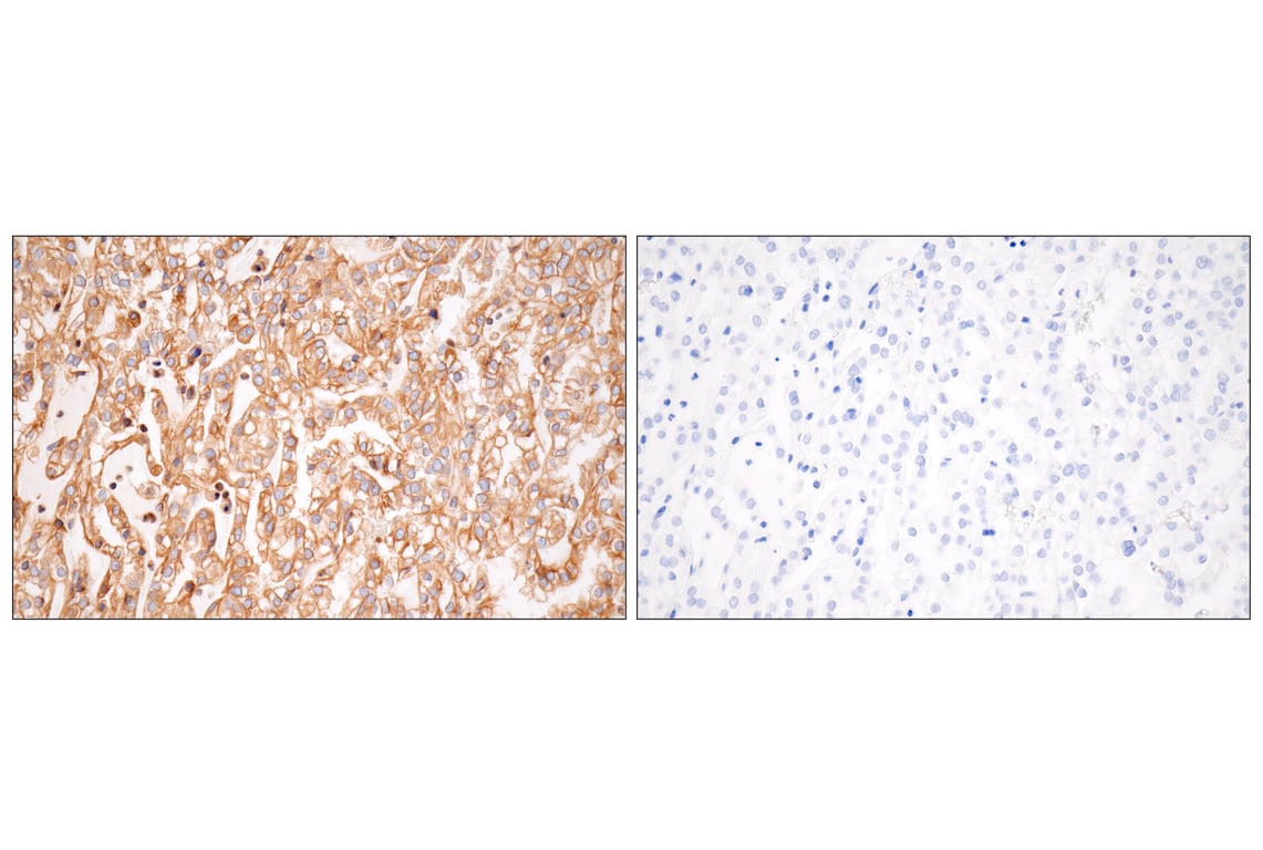 Immunohistochemistry Image 15: MHC Class I (EMR8-5) Mouse Monoclonal Antibody
