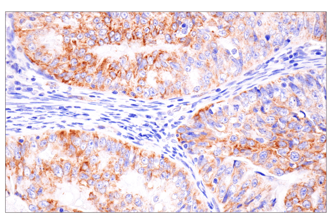 Immunohistochemistry Image 3: AMACR (F7T6V) Rabbit mAb
