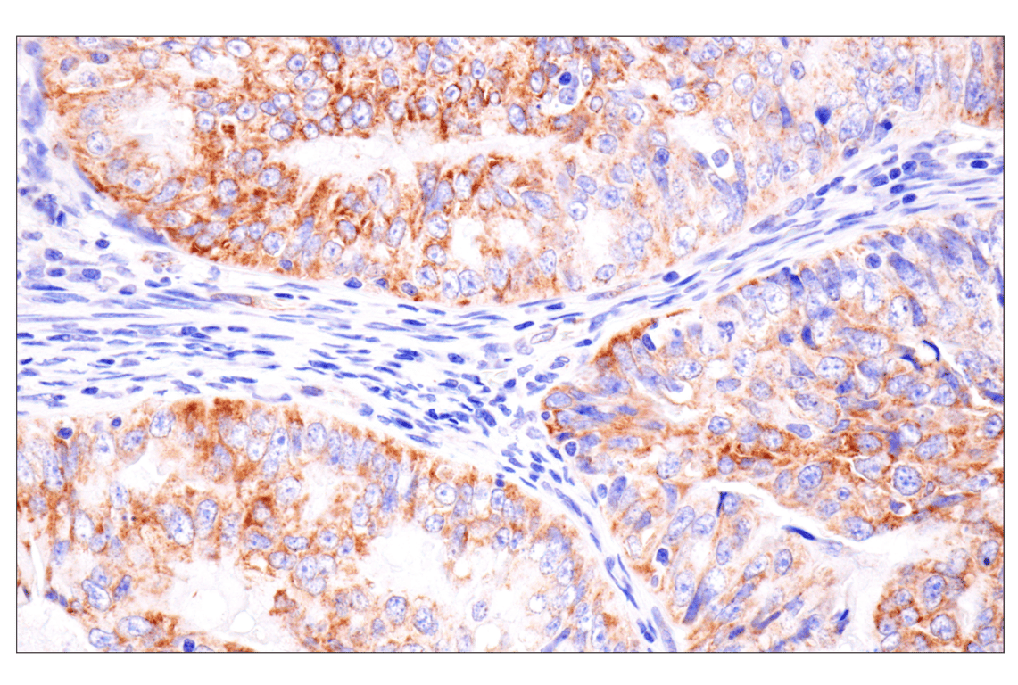 Immunohistochemistry Image 3: AMACR (F7T6V) Rabbit Monoclonal Antibody