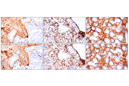 Immunohistochemistry Image 3: COL1A1 (E8F4L) Rabbit Monoclonal Antibody (BSA and Azide Free)