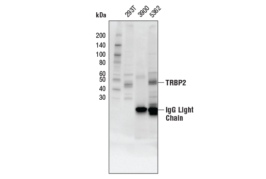 Immunoprecipitation Image 1: TRBP2 (D7C8K) Rabbit Monoclonal Antibody