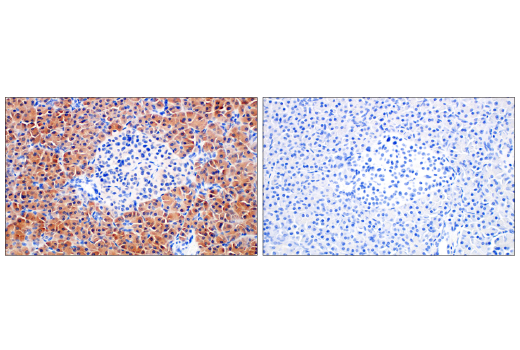 Immunohistochemistry Image 8: Asparagine Synthetase (E6C2C) Rabbit Monoclonal Antibody (BSA and Azide Free)