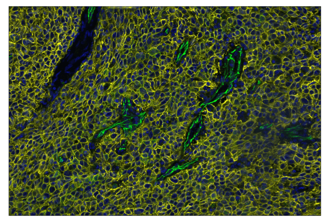 Immunohistochemistry Image 4: TACSTD2/TROP2 (F4W4J) & CO-0150-488 SignalStar<sup>™</sup> Oligo-Antibody Pair