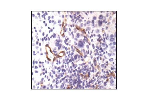 Immunohistochemistry Image 5: VEGF Receptor 2 (55B11) Rabbit Monoclonal Antibody (BSA and Azide Free)