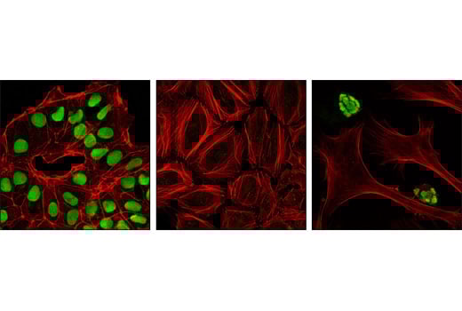 Immunofluorescence Image 1: Sox2 (L1D6A2) Mouse Monoclonal Antibody