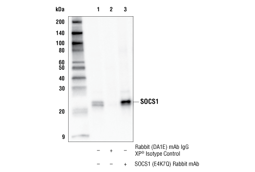 Immunoprecipitation Image 1: SOCS1 (E4K7Q) Rabbit Monoclonal Antibody
