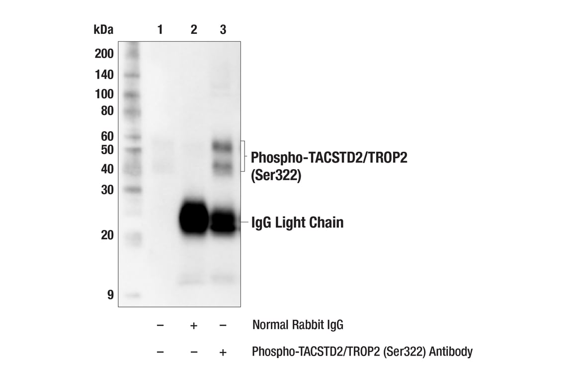 Immunoprecipitation Image 1: Phospho-TACSTD2/TROP2 (Ser322) Antibody
