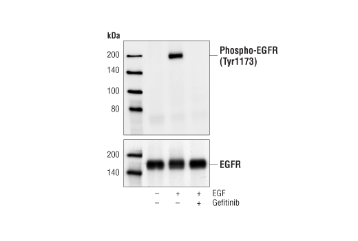 Western Blotting Image 1: Phospho-EGF Receptor (Tyr1173) (53A5) Rabbit mAb