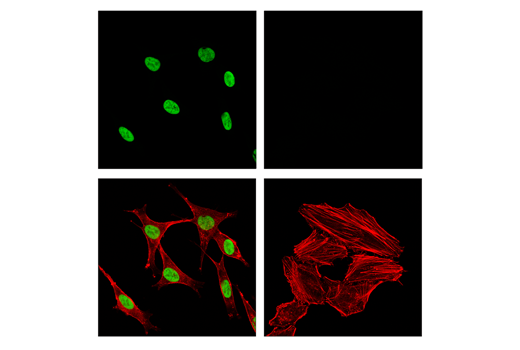 Immunofluorescence Image 1: Sox10 (E2V9N) Rabbit mAb (IF Formulated)