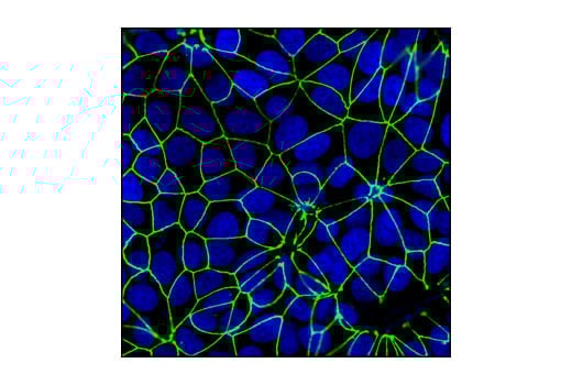 undefined Image 11: Tight Junction Antibody Sampler Kit