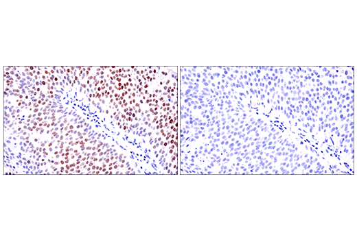 Immunohistochemistry Image 1: SATB1 (E5Z3U) Rabbit Monoclonal Antibody