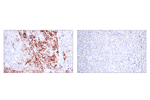 Immunohistochemistry Image 10: NCAM1 (CD56) (E7X9M) Rabbit Monoclonal Antibody