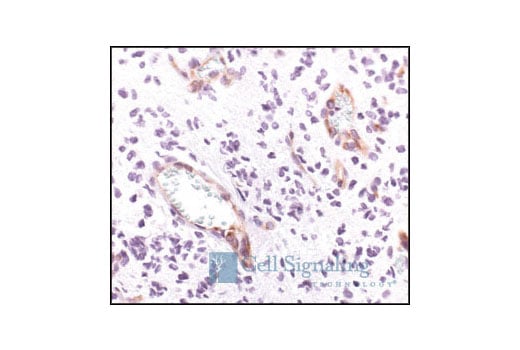 Immunohistochemistry Image 1: VEGF Receptor 2 (55B11) Rabbit Monoclonal Antibody