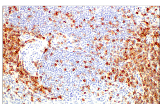 Immunohistochemistry Image 6: CD5 (E8X3S) Rabbit Monoclonal Antibody