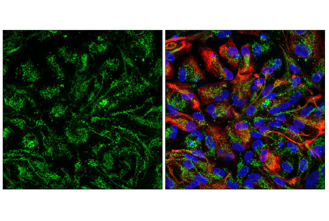 undefined Image 48: Electron Transport Chain (Complex II, III, IV) Antibody Sampler Kit