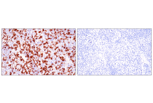 Immunohistochemistry Image 7: TIGIT (E5Y1W) Rabbit Monoclonal Antibody