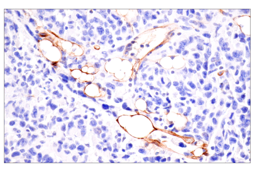 Immunohistochemistry Image 7: CD36 (E8B7S) Rabbit Monoclonal Antibody