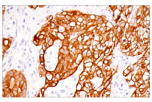 Immunohistochemistry Image 1: Pan-Keratin (5D3/LP34) Mouse Monoclonal Antibody