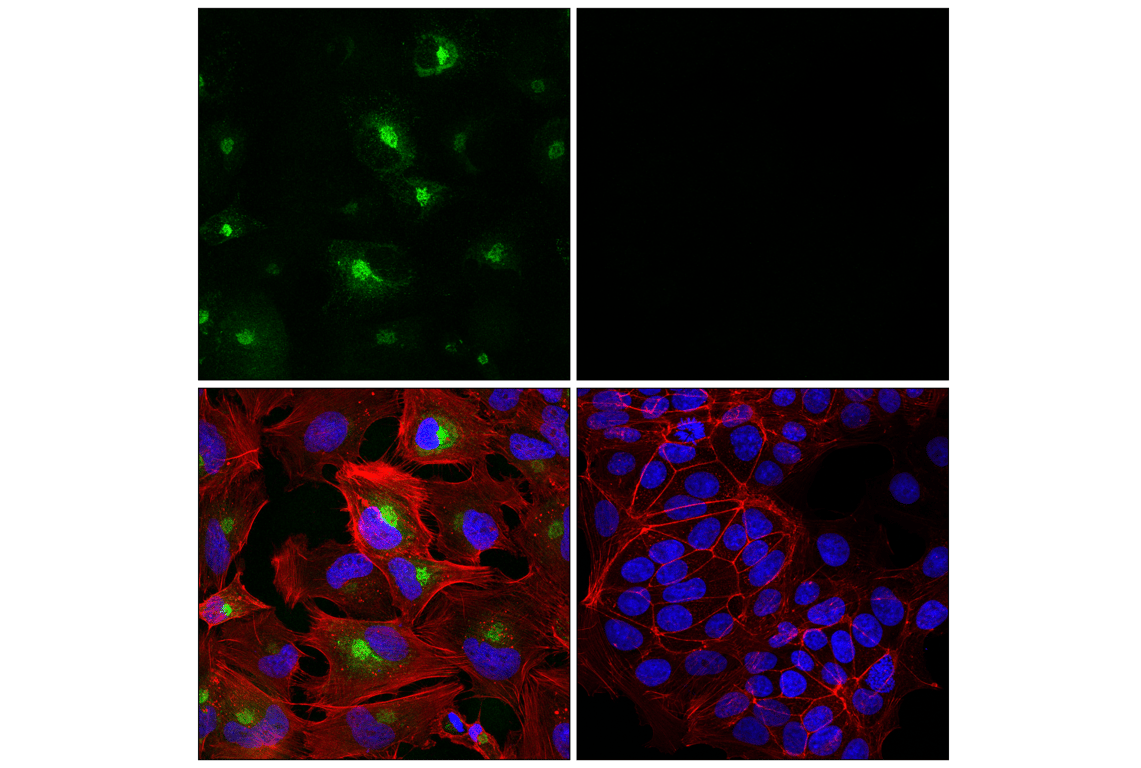 Immunofluorescence Image 1: Periostin (E3X1U) Rabbit Monoclonal Antibody