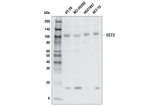 Western Blotting Image 1: ECT2 (E7V4L) Rabbit mAb