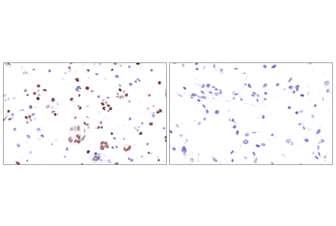 Immunohistochemistry Image 11: FoxP3 (221D) Mouse Monoclonal Antibody