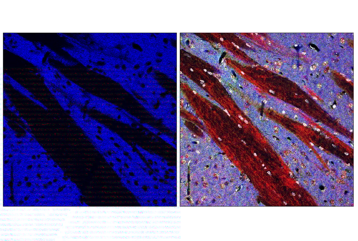 Immunofluorescence Image 3: Bassoon (D63B6) Rabbit Monoclonal Antibody (Alexa Fluor<sup>®</sup> 647 Conjugate)