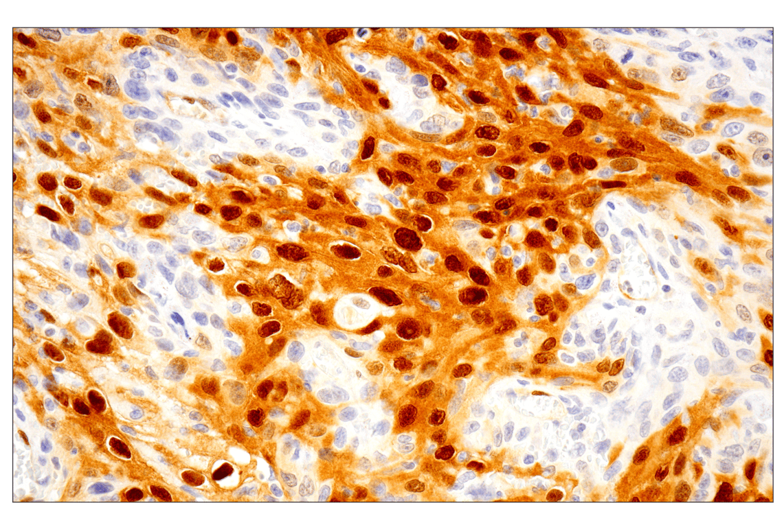 undefined Image 16: ALK Activation Antibody Sampler Kit