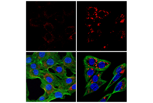 LAMP1 (E5N9Z) Rabbit mAb (Alexa Fluor® 594 Conjugate) | Cell