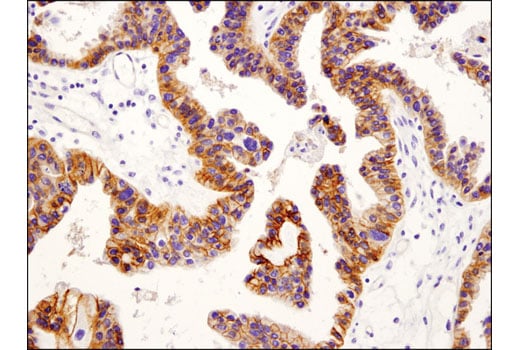 Immunohistochemistry Image 2: IGF-I Receptor beta (D4O6W) Rabbit Monoclonal Antibody