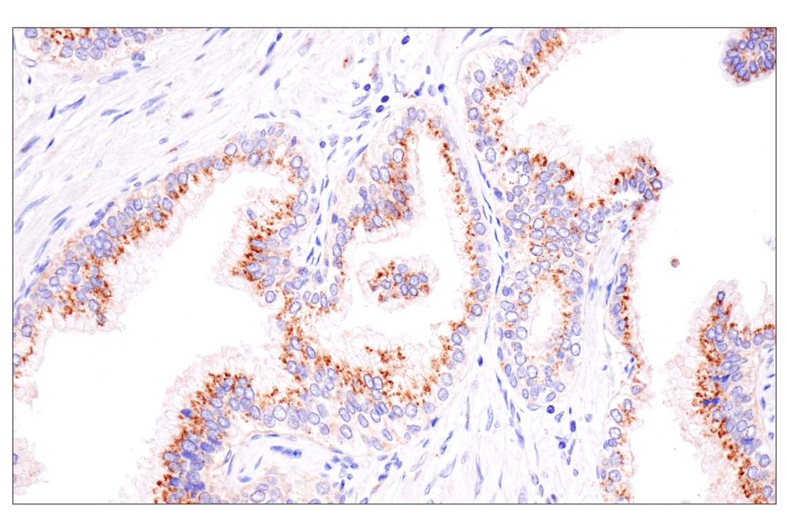 Immunohistochemistry Image 4: Presenilin 2 (F7E5Q) Rabbit Monoclonal Antibody