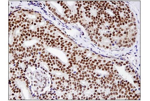 Immunohistochemistry Image 1: BRM (D9E8B) XP<sup>®</sup> Rabbit mAb