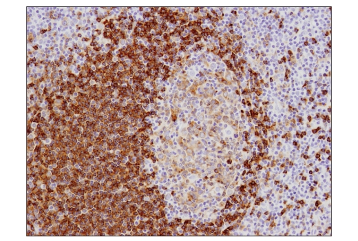 Immunohistochemistry Image 1: CD79B (D7V2F) Rabbit Monoclonal Antibody (BSA and Azide Free)