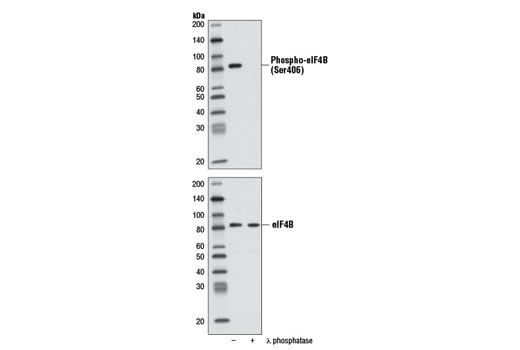 Western Blotting Image 1: Phospho-eIF4B (Ser406) (D1C10) Rabbit mAb