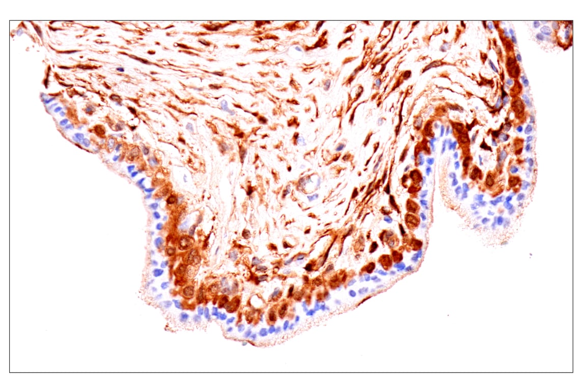 Immunohistochemistry Image 8: Phospho-YAP (Ser61) (E4Q8S) Rabbit Monoclonal Antibody